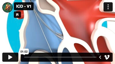 2D animatie project UMC